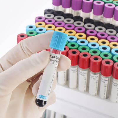 kupować Vacuum EDTA Blood Tubes for Complete Blood Count (CBC) – High Quality, Secure Seal produkcja internetowa